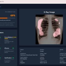 UGM Luncurkan TBScreen.AI, Aplikasi Skrining TBC Berbasis AI Pertama di Indonesia